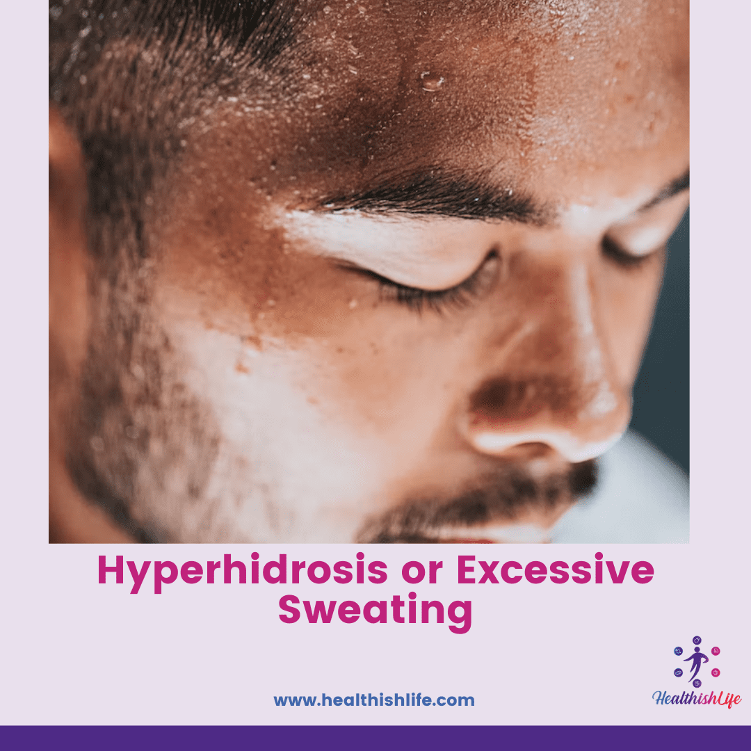 What is Hyperhidrosis or Excessive Sweating? Symptoms, Causes ...